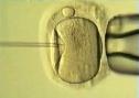 Fecundación in vitro | Recurso educativo 28597