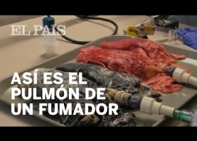 Així es transforma el pulmó d'un fumador | Recurso educativo 786389