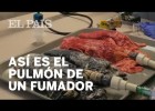 Així es transforma el pulmó d'un fumador | Recurso educativo 786389